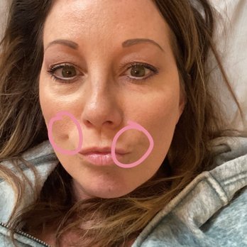 Arizona Facial Plastics - Plastic Surgeons Near Me - Phoenix, Arizona Arizona Facial Plastics - Plastic Surgeons Near Me - Phoenix, Arizona