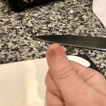 Bijou Nails - Bruise 24 days after a powder gel manicure - Nail Salons Near Me - New York, New York