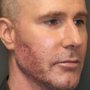 Utah Dermatologic & Medical Procedures Clinic