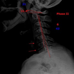 Ithaca Family Chiropractic - Digital X-Ray on site