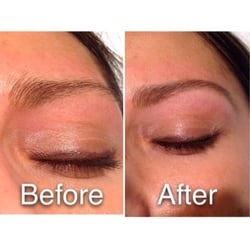Brow and Skin