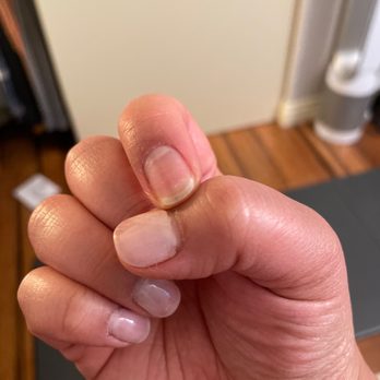 Perfect Nails Spa - Day 6 and I'm down a nail. Wonder how long the rest will last... - Nail Salons Near Me - American Canyon, California