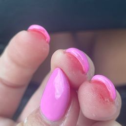 Picture shows 2 of the 3 cuts I got from the drill, one still bloody. Picture shows 2 of the 3 cuts I got from the drill, one still bloody.