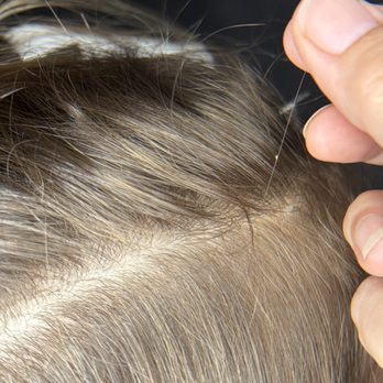 Healthy Heads - Lice Services Near Me - Pamplico, South Carolina Healthy Heads - Lice Services Near Me - Pamplico, South Carolina