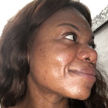 Derm by Erica - Skin Care Near Me - Culver City, California