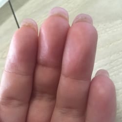 Regal Nails, Salon & Spa - Taken the second I got home. Uneven, poorly shaped nails with protruding under nails.