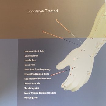 Brown Chiropractic & Acupuncture, PC - Chiropractors Near Me - Gilbert, Arizona
