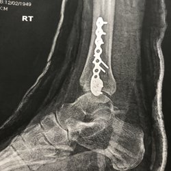 The Bone & Joint Center - Xray