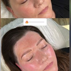 Olive Branch Brows - Before and after
