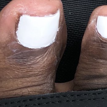 You Got Nail - Toenails uneven and cut to the meat - Hair Salons Near Me - Alexandria, Virginia You Got Nail - Toenails uneven and cut to the meat - Hair Salons Near Me - Alexandria, Virginia