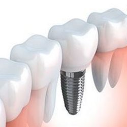 Saratoga Family Dentistry