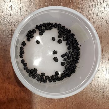 Sharp Coronado Hospital - Gallstone. All 105 of 'em. Thank you, Dr. Bench! - Hospitals Near Me - Coronado, California
