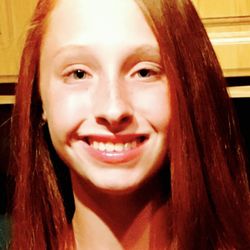 Robert F Schwartz, DDS, MS - Schwartz Orthodontics - After!!!