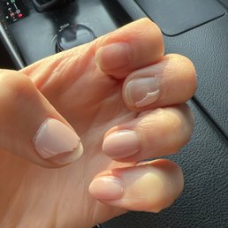 left hand 10 days after dip