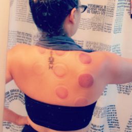 The darker the circles, the more toxins being brought to the top! Wow these are dark. I was HURTING before paying a visit.