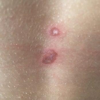 Chuck E. Cheese - Now beacuse of chuck e cheese, she will Have scars on her back forever - Pizza Near Me - San Bernardino, California