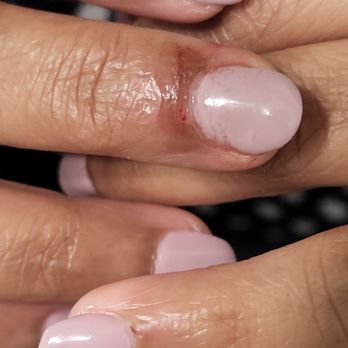 Silk-Tek Nail Care - Pathetic service,The 2 cuts are clearly visible in pictures how bad it was. I'll never recommend this place. - Nail Salons Near Me - Fremont, California Silk-Tek Nail Care - Pathetic service,The 2 cuts are clearly visible in pictures how bad it was. I'll never recommend this place. - Nail Salons Near Me - Fremont, California