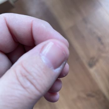 Passion Nails & Lash - super short nail, no length left - Nail Salons Near Me - Albany, New York
