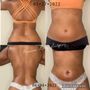 Photo of Roxanne Body Sculpting