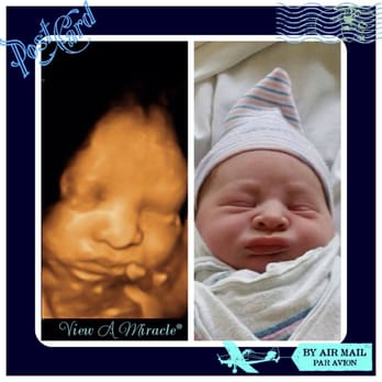 View A Miracle - My miracle - Ultrasound Imaging Centers Near Me - East Brunswick, New Jersey View A Miracle - My miracle - Ultrasound Imaging Centers Near Me - East Brunswick, New Jersey