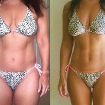 Lite Body Sculpting - Weight Loss Centers Near Me - Citrus Heights, California Lite Body Sculpting - Weight Loss Centers Near Me - Citrus Heights, California