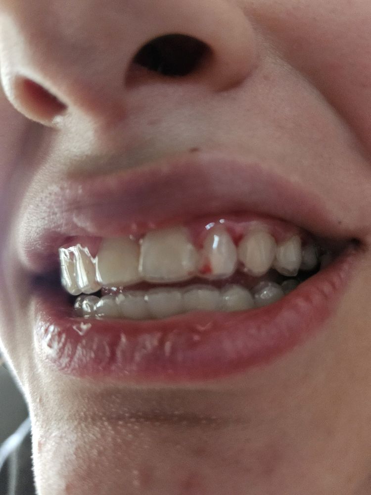 Ridder Orthodontics - patient advocate in Keller, TX