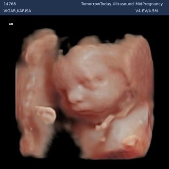 TomorrowToday Ultrasound - Ultrasound Imaging Centers Near Me - Aiea, Hawaii TomorrowToday Ultrasound - Ultrasound Imaging Centers Near Me - Aiea, Hawaii