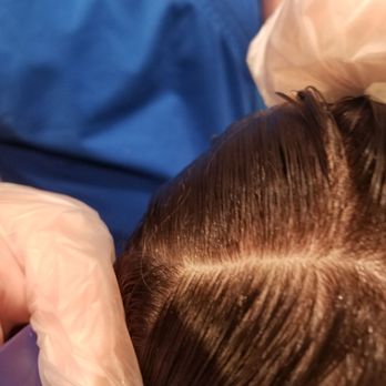 Lice Is Tiny Black Dot Yelp