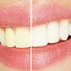 Vineyard Family Dental Office
