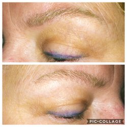 Microblading side view