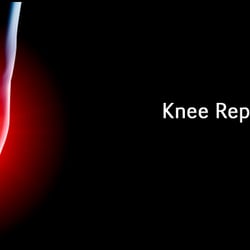 Pomeroy Donald L MD - David P Rhoads Orthopedics surgeon