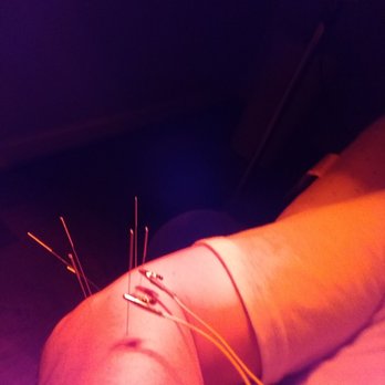 For Your Pains Acupuncture - Acupuncture Near Me - Annandale, Virginia For Your Pains Acupuncture - Acupuncture Near Me - Annandale, Virginia