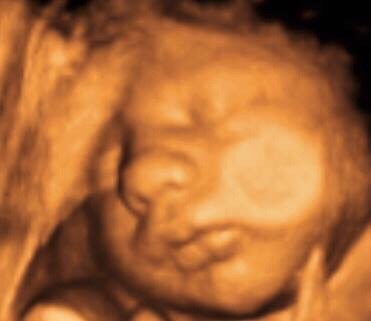 Stork Secret Hattiesburg