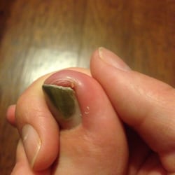 Nail Pro - 3 months later and I'm still paying for this pedicure! DO NOT GO HERE!