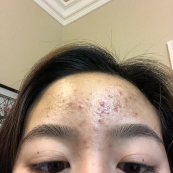 Yerin Skincare - Skin Care Near Me - Rancho Cordova, California Yerin Skincare - Skin Care Near Me - Rancho Cordova, California