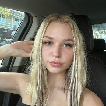 Beverly Hills Plastic Surgeons - Post facial glow! - Medical Spas Near Me - Newport Beach, California Beverly Hills Plastic Surgeons - Post facial glow! - Medical Spas Near Me - Newport Beach, California