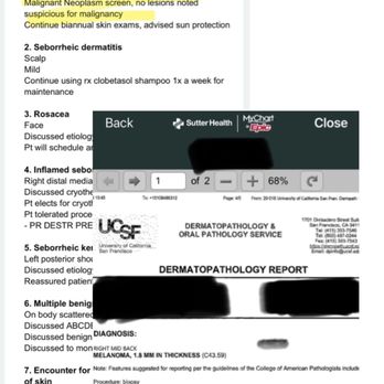 AllSkin Dermatology - Screenshot of clinical notes from past visit details highlighting benign remarks, pathology report noting melanoma in foreground. - Dermatologists Near Me - Berkeley, California