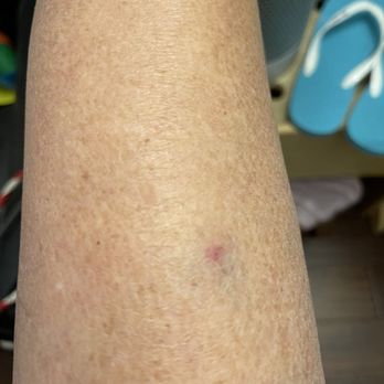 Costco Wholesale - DOG BITE AT COSTCO *** - Wholesale Stores Near Me - Torrance, California Costco Wholesale - DOG BITE AT COSTCO *** - Wholesale Stores Near Me - Torrance, California