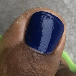 In salon, post pedicure and drying. Nothing touched this nail after technician finished. In salon, post pedicure and drying. Nothing touched this nail after technician finished.