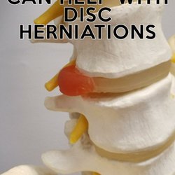 Capstone Chiropractic - Chiropractic is the leading preventative and corrective treatment for disc herniation and lower back pain.