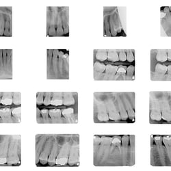 Rubinstein D Kenneth , DMD - Digital Xrays Taken
