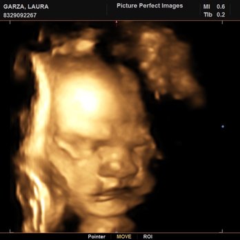 Picture Perfect 3D 4D - Ultrasound Imaging Centers Near Me - Houston, Texas Picture Perfect 3D 4D - Ultrasound Imaging Centers Near Me - Houston, Texas