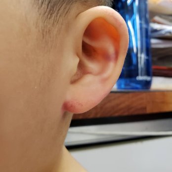 Hands Christian Daycare - Injury he told us he got from a teacher there - Child Care & Day Care Near Me - Centreville, Virginia Hands Christian Daycare - Injury he told us he got from a teacher there - Child Care & Day Care Near Me - Centreville, Virginia