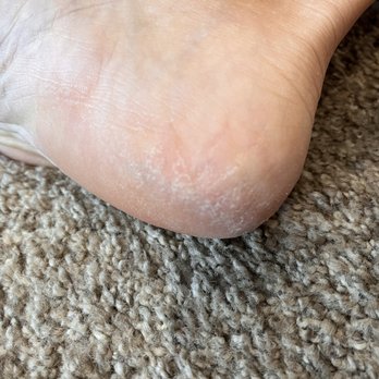 Shiloh Nails & Spa - 1 hour post-pedi with Mary. Sorry for the gross foot pic but I too am disgusted and thought it might be helpful for someone else. - Nail Salons Near Me - Windsor, California Shiloh Nails & Spa - 1 hour post-pedi with Mary. Sorry for the gross foot pic but I too am disgusted and thought it might be helpful for someone else. - Nail Salons Near Me - Windsor, California