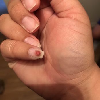 Polished Nails - Filed nail until she reached skin!!! - Nail Salons Near Me - Montclair, California Polished Nails - Filed nail until she reached skin!!! - Nail Salons Near Me - Montclair, California