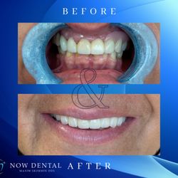 Now Dental