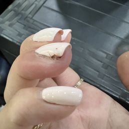 Got a gel manicure and a nail infection (4 days after visiting LUV) Got a gel manicure and a nail infection (4 days after visiting LUV)