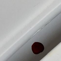 Inland Valley Hospital - Blood dripped all over the bathroom