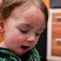 Photo of Children's Dermatology - Orange