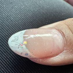 Shiny Nails - Nail has hair